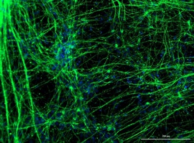 Novel Coronavirus can infect human neurons